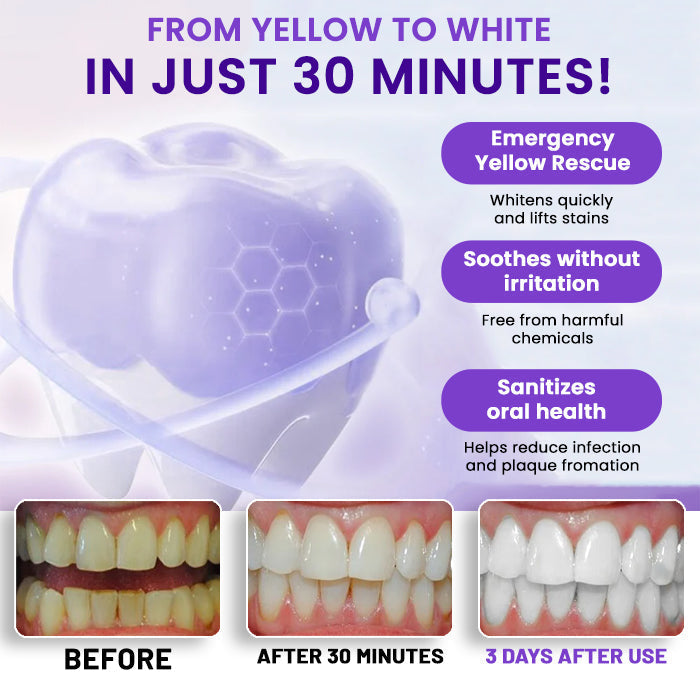 V34 Whitening Strips