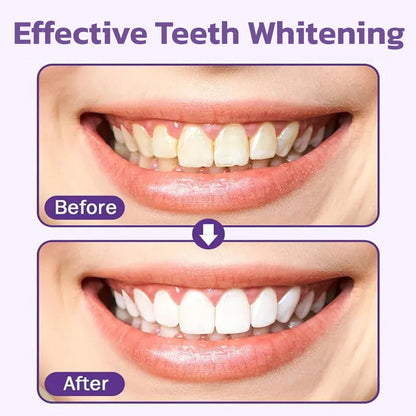 SUMMER SALE 60% OFF🔥 Advanced Mineral Whitening Tooth Powder - Removes Stains, No Sensitivity