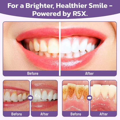 SUMMER SALE 60% OFF🔥 Advanced Mineral Whitening Tooth Powder - Removes Stains, No Sensitivity