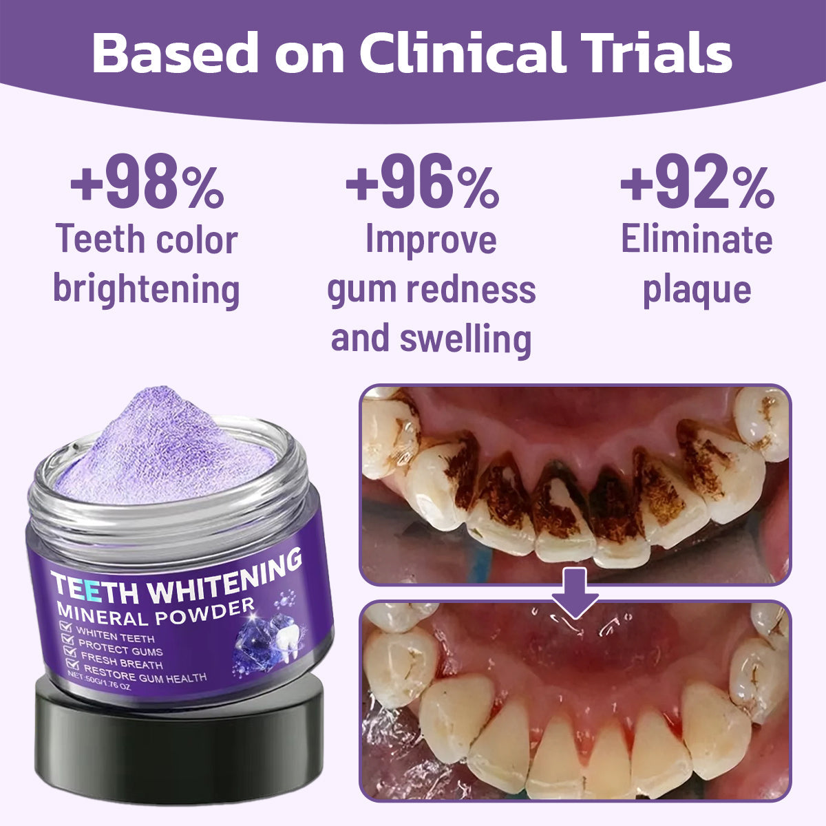 SUMMER SALE 60% OFF🔥 Advanced Mineral Whitening Tooth Powder - Removes Stains, No Sensitivity