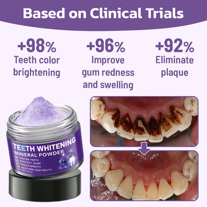 SUMMER SALE 60% OFF🔥 Advanced Mineral Whitening Tooth Powder - Removes Stains, No Sensitivity