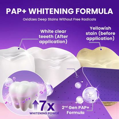 V34 Whitening Strips